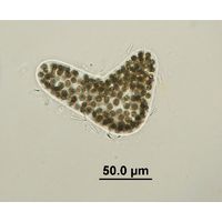 Microcystis wesenbergii