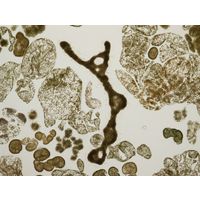 Microcystis spp.