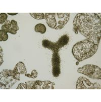 Microcystis spp.