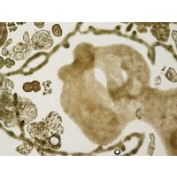 Microcystis spp.