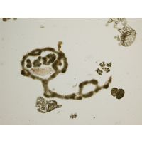 Microcystis spp.