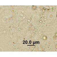 Rhabdoderma vermiculare