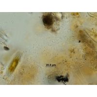 Rhabdoderma vermiculare