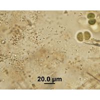 Rhabdoderma vermiculare