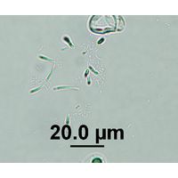 Rhabdoderma vermiculare
