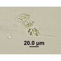 Rhabdogloea linearis