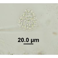 Snowella litoralis