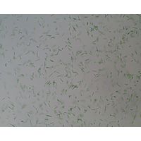 Synechococcus bigranulatus