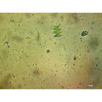 Synechococcus