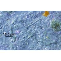 Tryponema cf. endolithicum