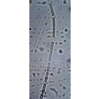 Wolskyella cf. australis
