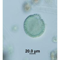 Woronichinia karelica