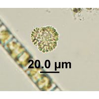 Woronichinia cf. karelica