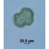 Woronichinia naegeliana
