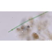 Anabaena aequalis