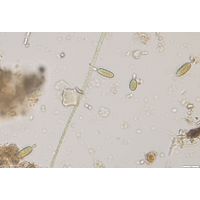 Cylindrospermum stagnale