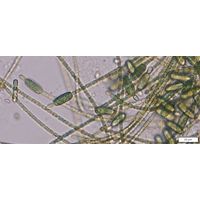 Cylindrospermum stagnale