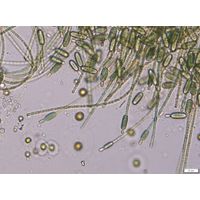 Cylindrospermum stagnale