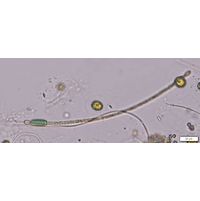 Cylindrospermum stagnale