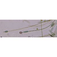 Cylindrospermum stagnale