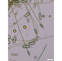 Cylindrospermum stagnale