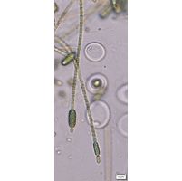 Cylindrospermum stagnale