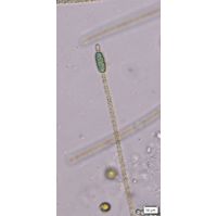 Cylindrospermum stagnale