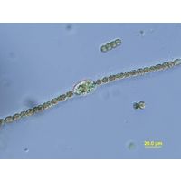 Dolichospermum danicum