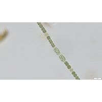 Dolichospermum planctonicum