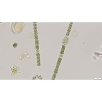 Dolichospermum planctonicum