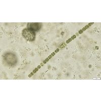 Dolichospermum planctonicum