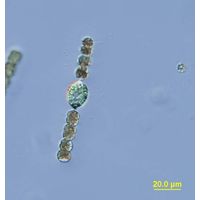 Dolichospermum planctonicum