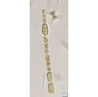 Dolichospermum macrosporum