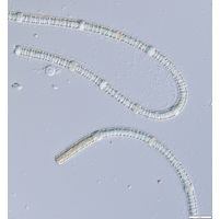 Nodularia spumigena