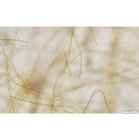 Anagnostidinema amphibium 
