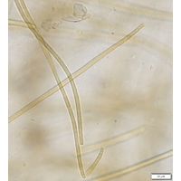 Anagnostidinema amphibium 
