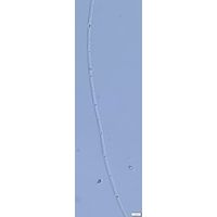Limnothrix redekei