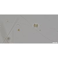 Limnothrix redekei