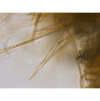 Phormidium beggiatiformis