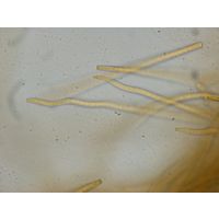 Phormidium beggiatiformis