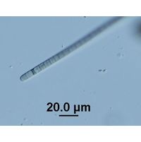 Phormidium lividum