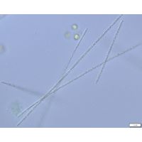 Planktothrix agardhii