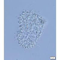 Anathece minutissima