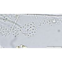 Anathece bachmannii