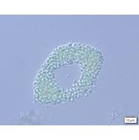 Aphanocapsa elegans