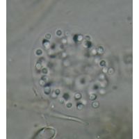 Aphanocapsa grevillei