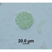 Aphanocapsa incerta