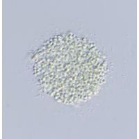 Aphanocapsa incerta