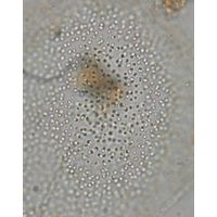 Aphanocapsa planctonica
