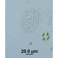 Aphanocapsa planctonica